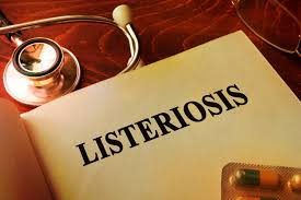 What you need to know about listeriosis